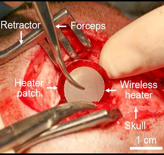 Devices for Controlled Drug Delivery